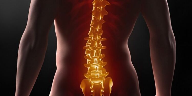Sakralinio stuburo osteochondrozė